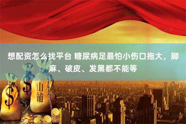 想配资怎么找平台 糖尿病足最怕小伤口拖大，脚麻、破皮、发黑都不能等